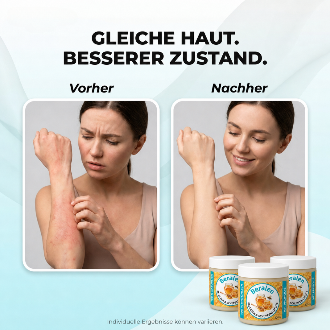 Beralen™ – Repair Balsam bei Ekzem & Schuppenflechte